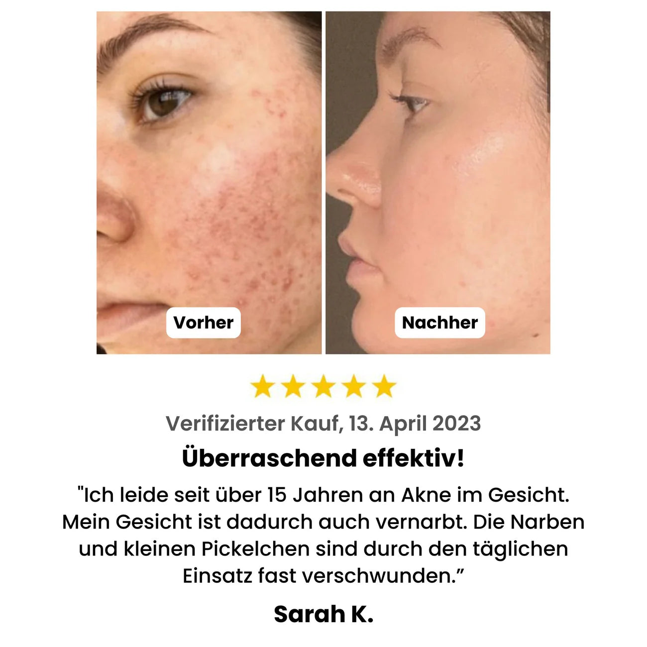 AquaPure Porenreiniger