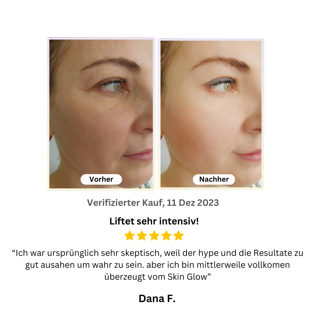 Skin Glow - IntensivLifting